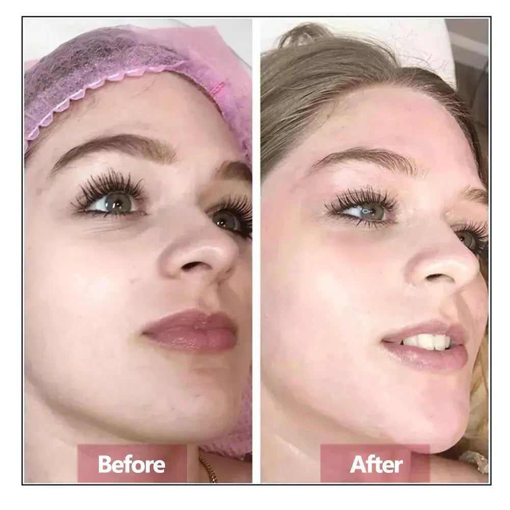 Sérum pour le visage à l'acide hyaluronique Essence Réparation cutanée Rajeunissement Raffermissant Hydratant Hydratation Anti-âge